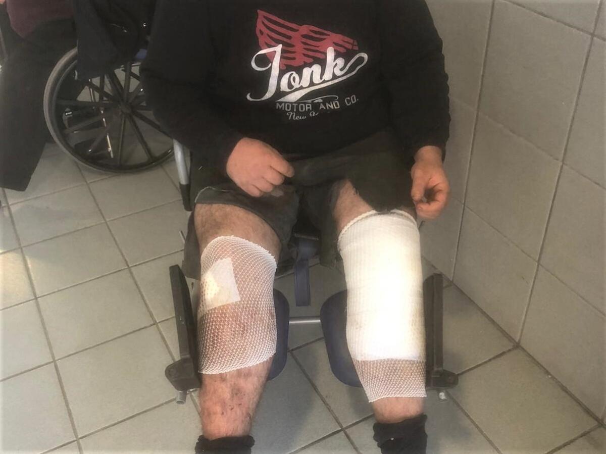 Giovane agricoltore aggredito e ferito da un cinghiale - 