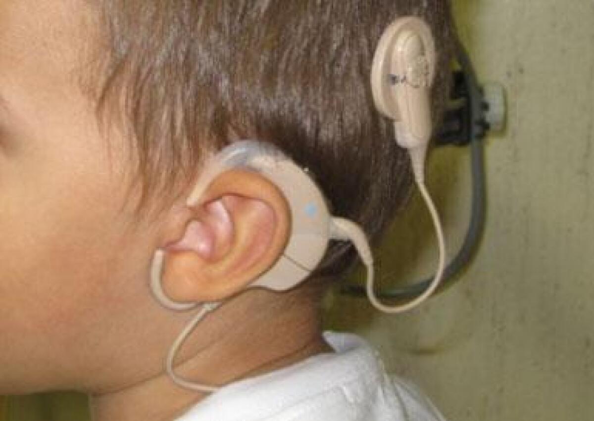 Sordità, Alaia a De Luca: autorizzi il 'Moscati' ad applicare gli impianti cocleari - 
