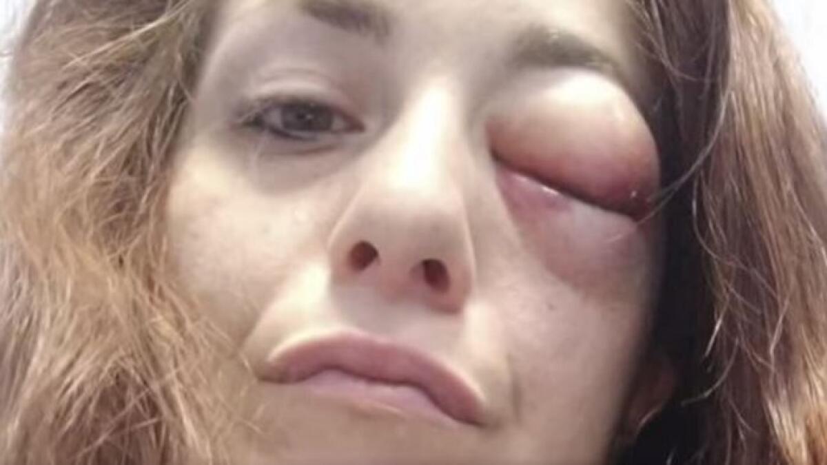 Giuliana Danzè attraverso denuncia l'aggressione subita dal compagno - 