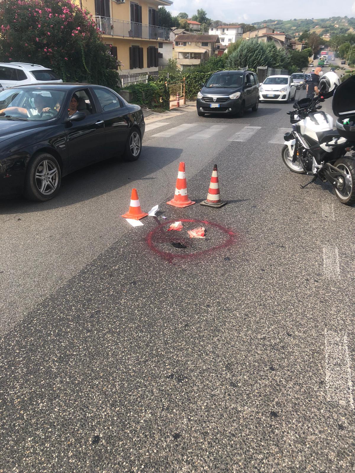 Benevento. Una 40 enne viene investita da un auto e riporta frattura del bacino - 