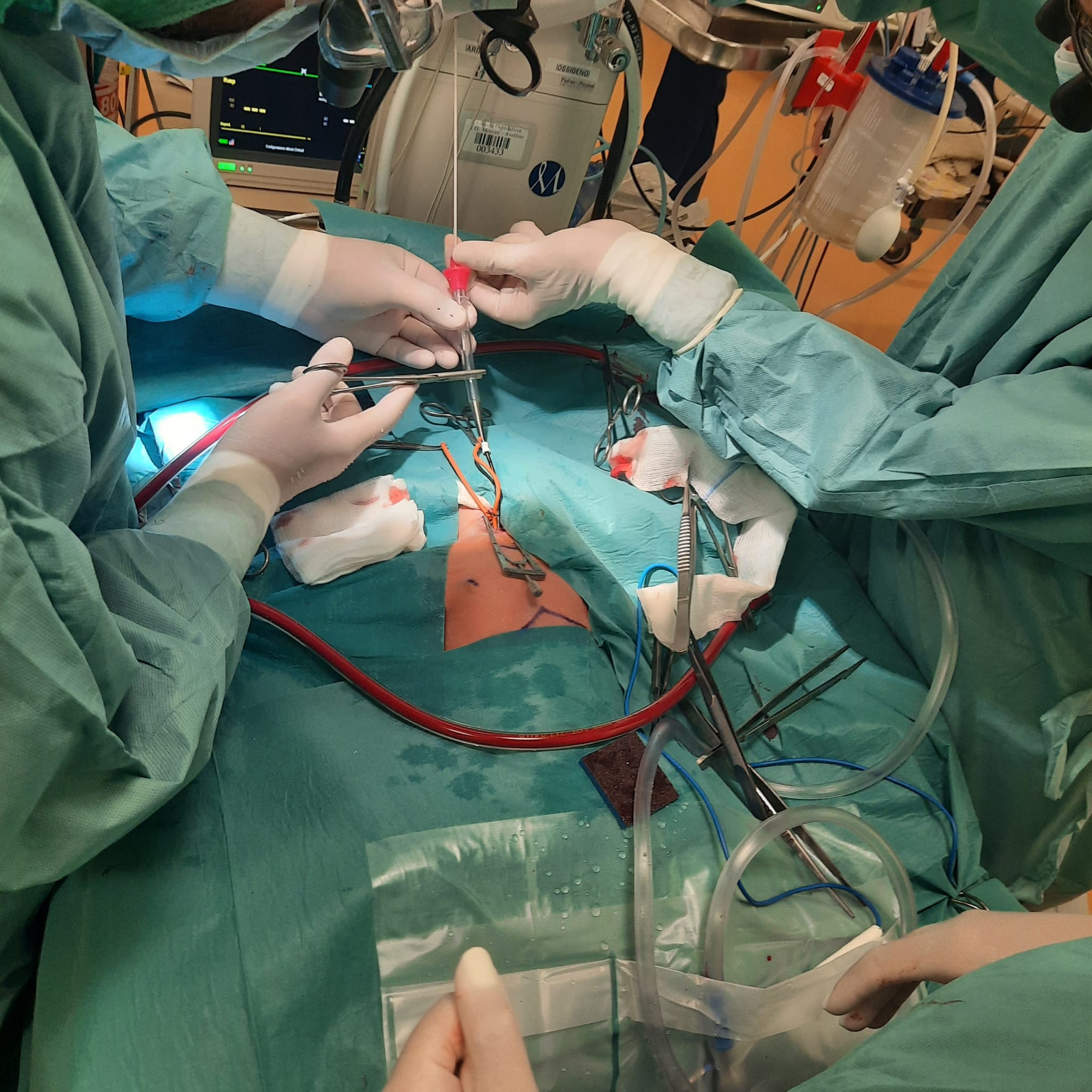 Straordinario lavoro di squadra salva la vita a un neonato