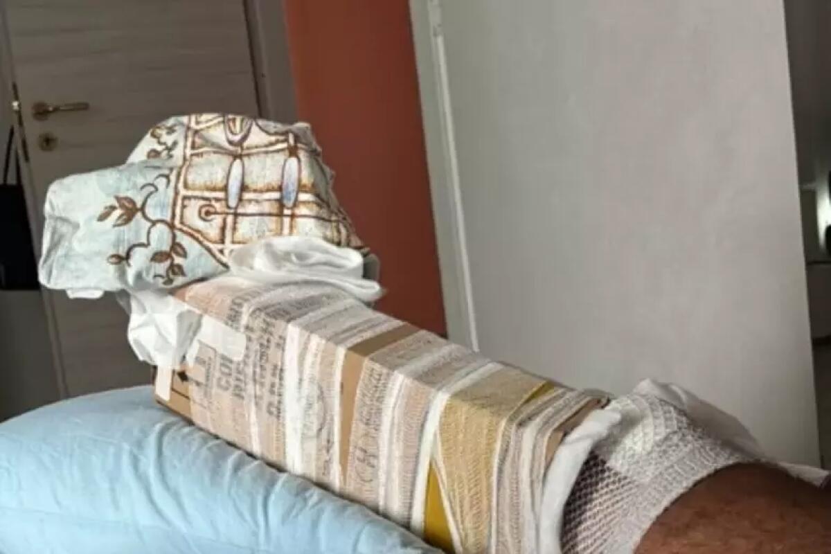 Frattura steccata con un cartone, rimosso responsabile pronto soccorso. - 