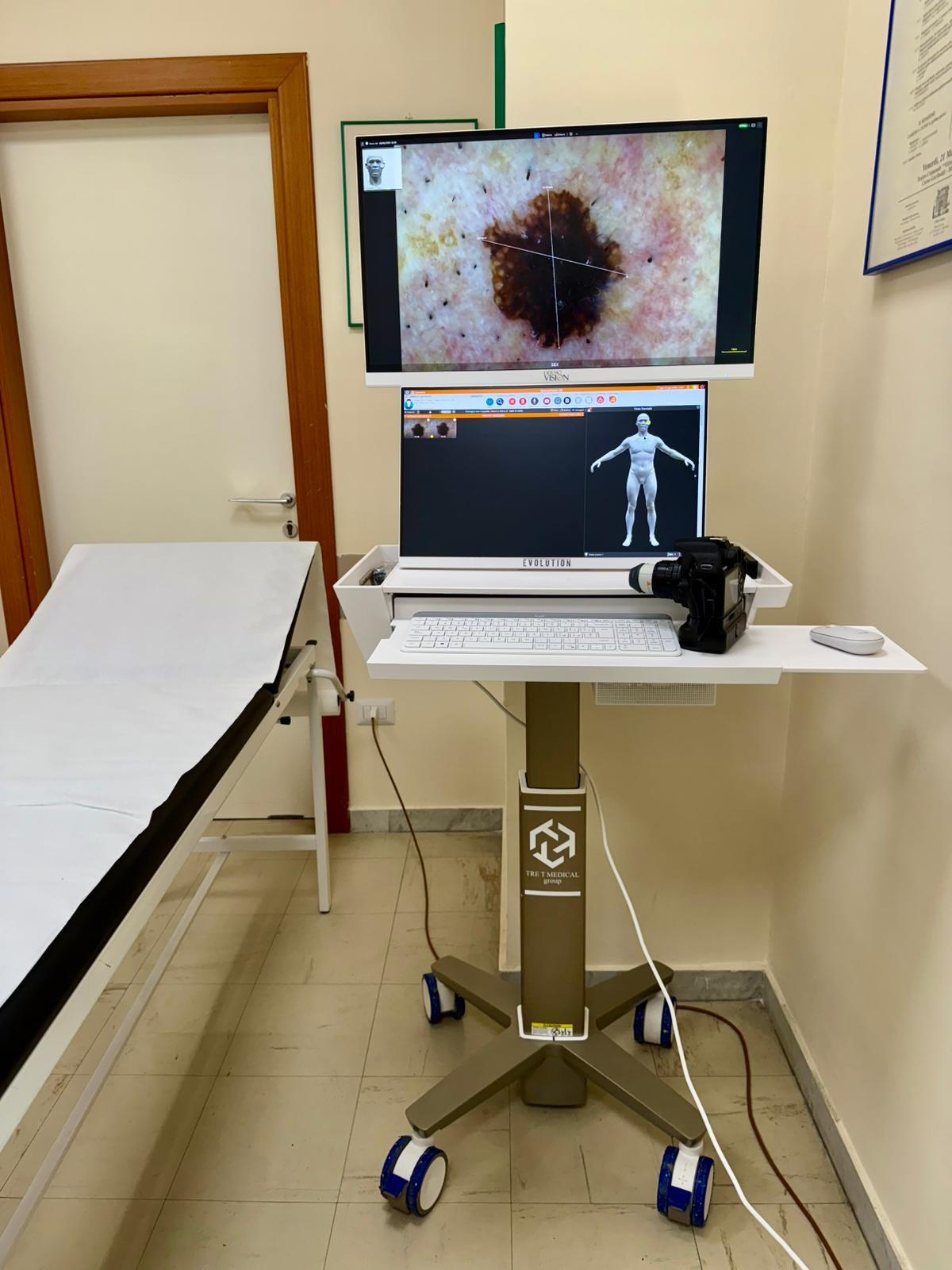AORN “San Pio”, introdotti il Videodermatoscopio e la Cabina di Fototerapia. - 