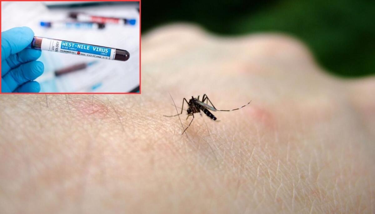 Limone: ci sono 111 casi di West Nile in Campania  - 