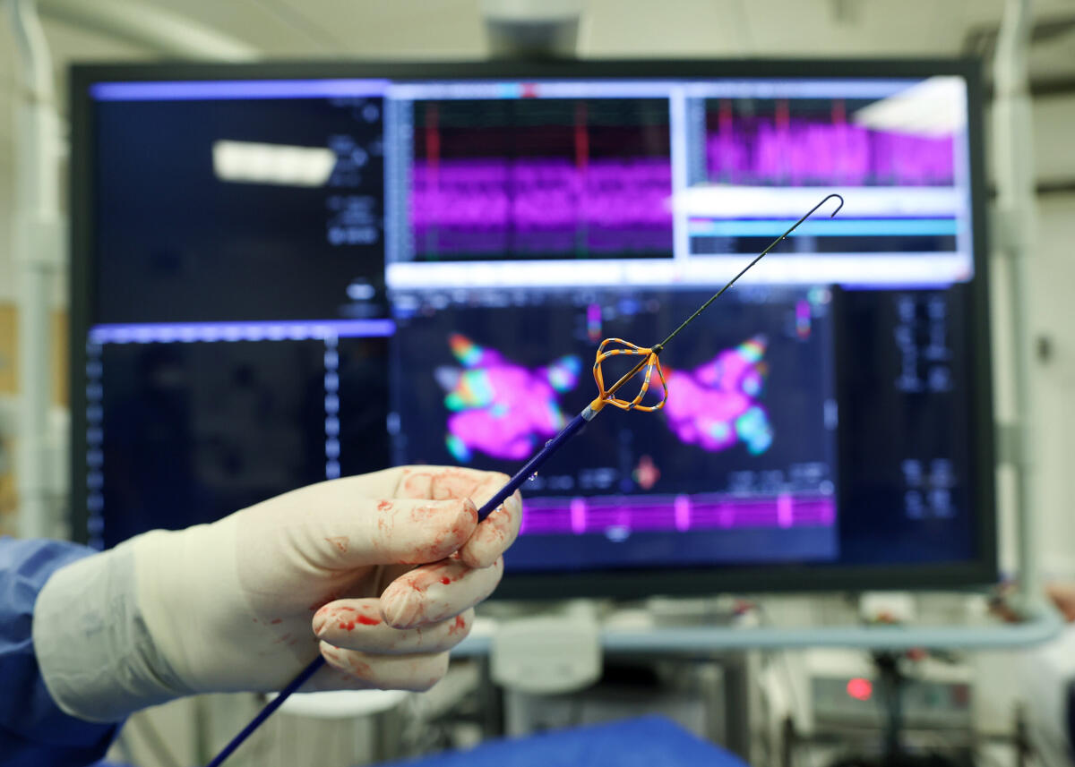 Fatebenefratelli Benevento. Eseguite per la prima volta due ablazioni a “Campo Pulsato” per il trattamento della fibrillazione atriale - 