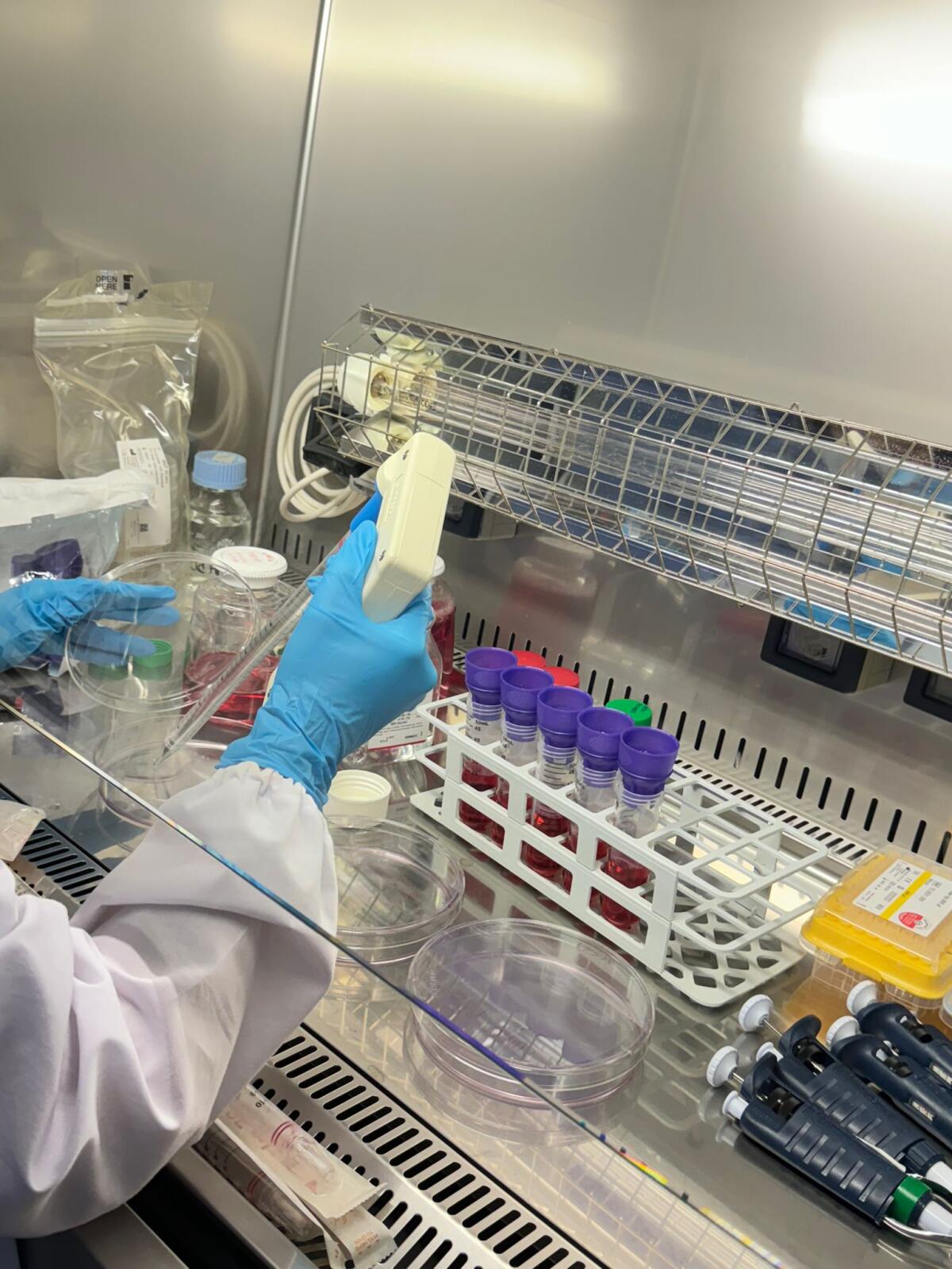 Studio Biogem-Vanvitelli identifica nuovo soppressore del carcinoma epatocellulare - 