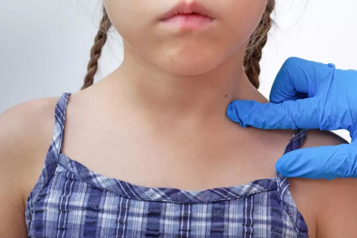 Sclerosi multipla, la mononucleosi può essere una causa pure nei bambini - 