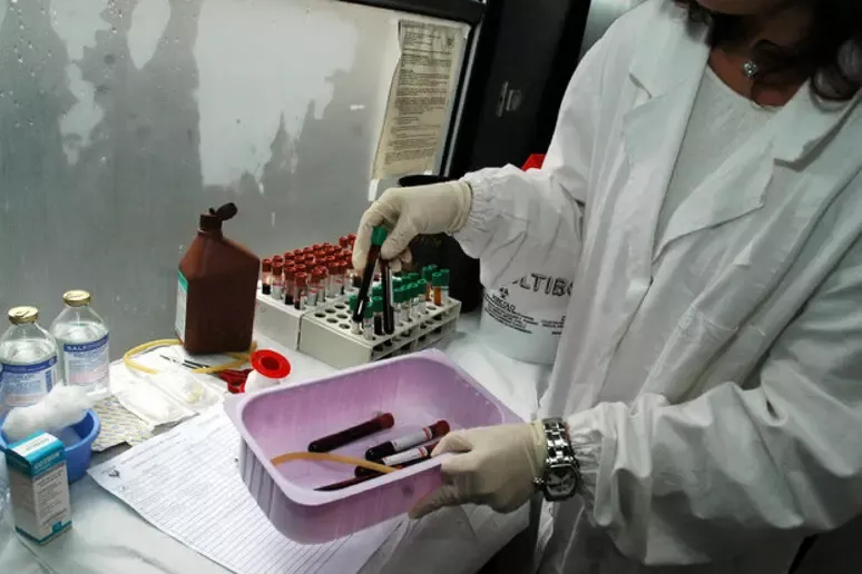 Epatite A in Campania: 133 casi e allerta molluschi bivalvi - 