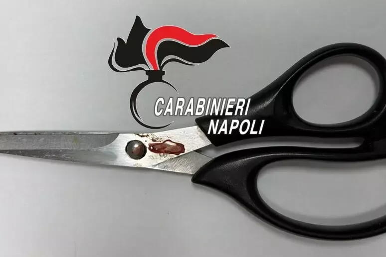 66enne aggredisce la moglie e l'accoltella con le forbici - 
