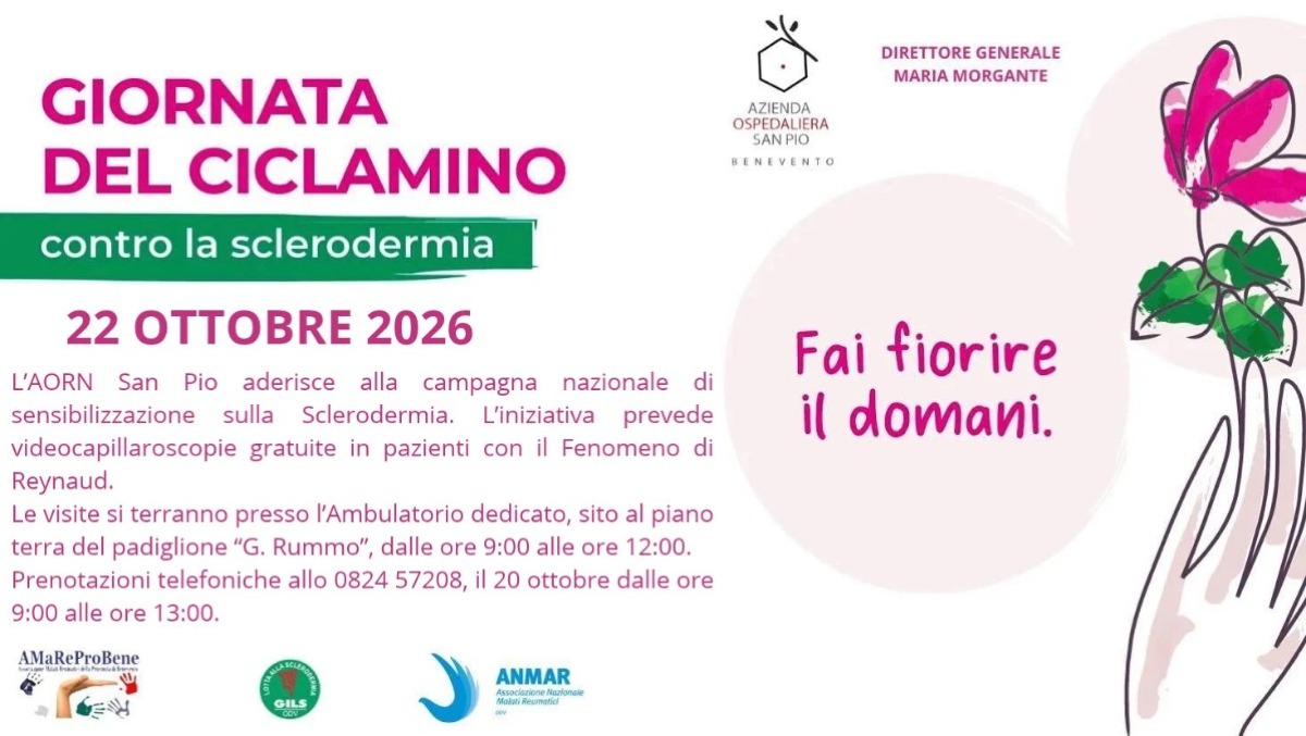 A.O. San Pio aderisce alla campagna di sensibilizzazione sulla Sclerodermia - 